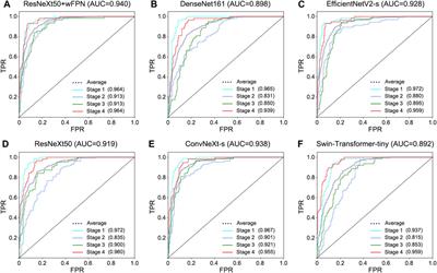 A novel deep-learning based weighted feature fusion architecture for precise classification of pressure injury